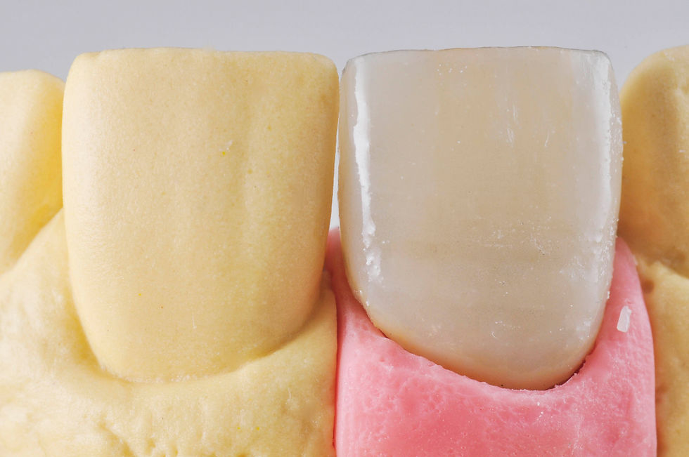 Image courtesy of: dr. Luigi Canullo