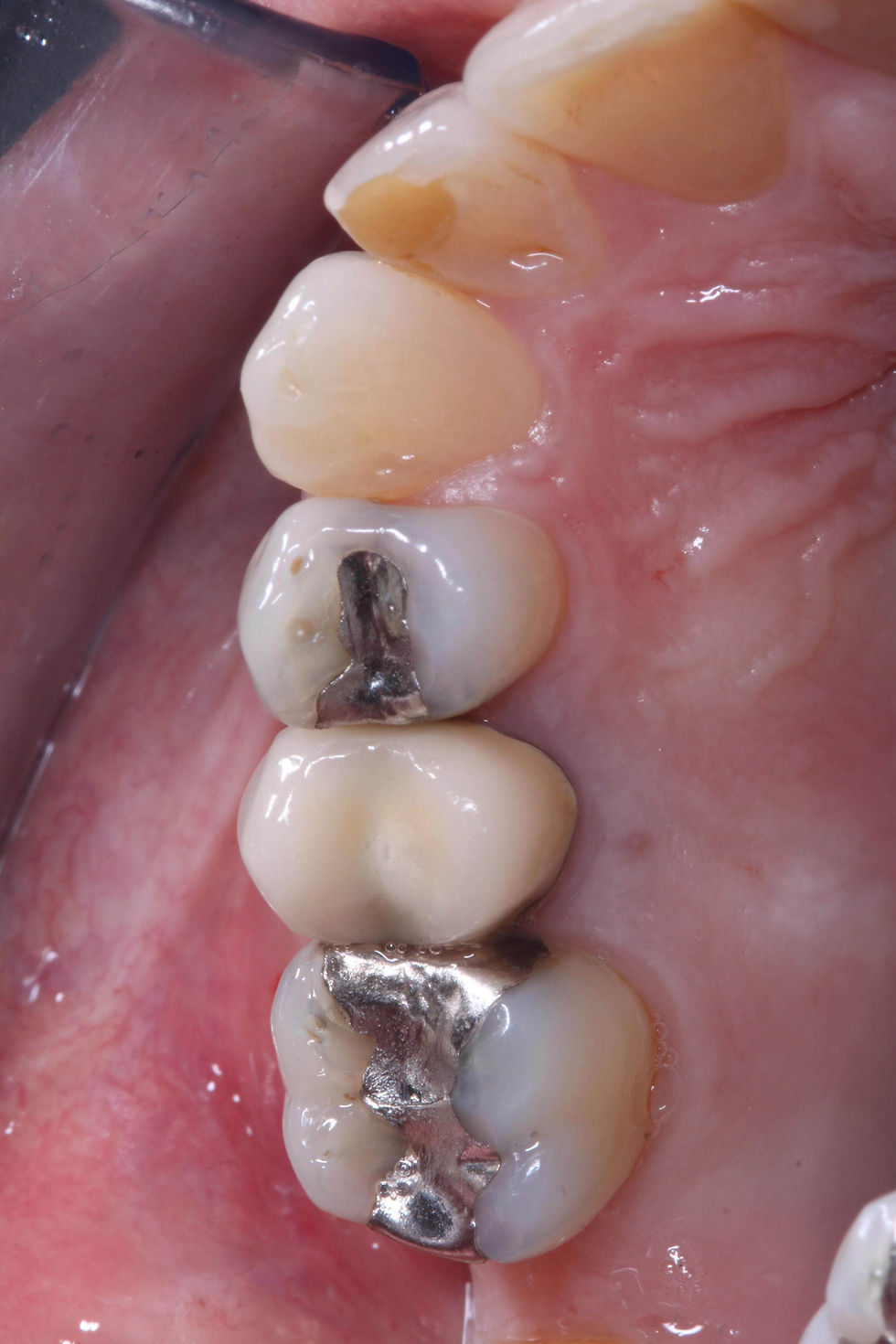 Foto per gentile concessione: Dott. Davide Guglielmi, Dott. Roberto Castellano.