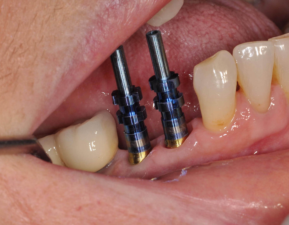 Image courtesy of: Prof. Marco Gargari, Dr. Federico Guzzo