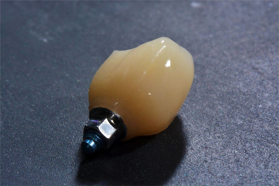 Image courtesy of: Dr. Costantino Vignato, Dr. Giuseppe Vignato.