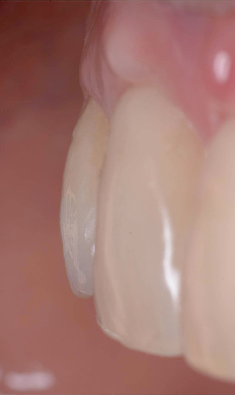 Image courtesy of: Dr. Giuseppe Pellitteri