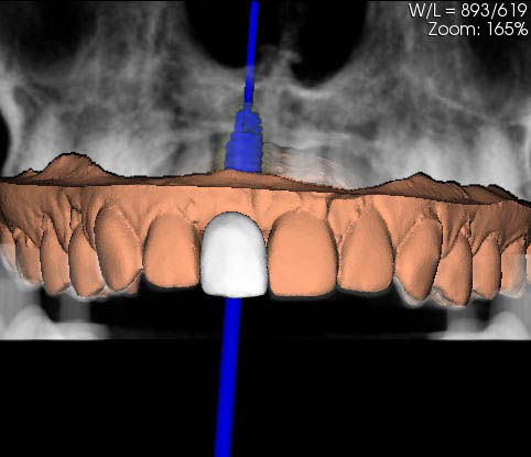 Image courtesy of: Prof. Berta GarcÃa Mira