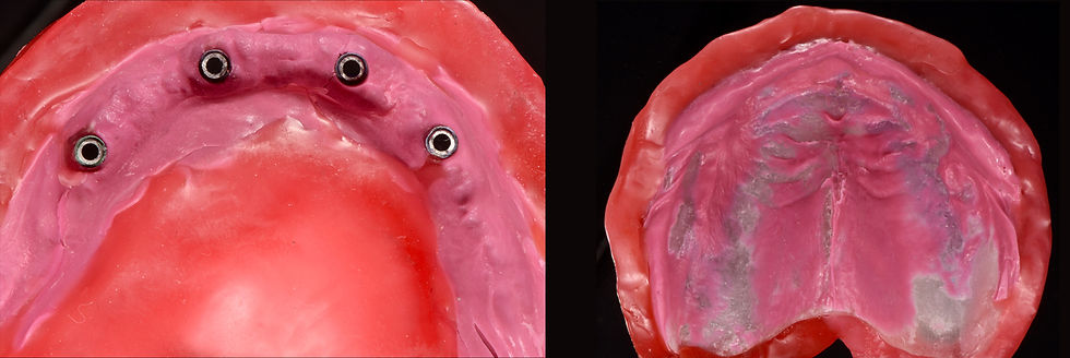 Image courtesy of: Gabriele Gori