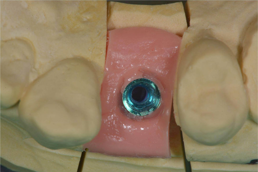 Image courtesy of: Dr. Costantino Vignato, Dr. Giuseppe Vignato.