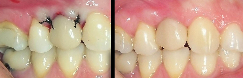 Image courtesy of: Dr. Guillermo Cabanes Gumbau