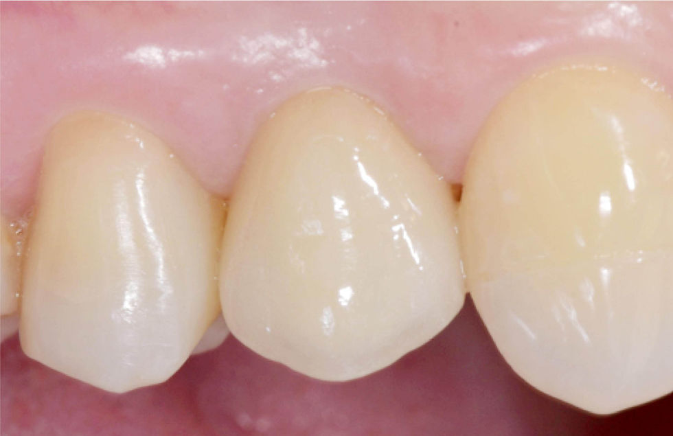 Image courtesy of: Dr. Costantino Vignato, Dr. Giuseppe Vignato