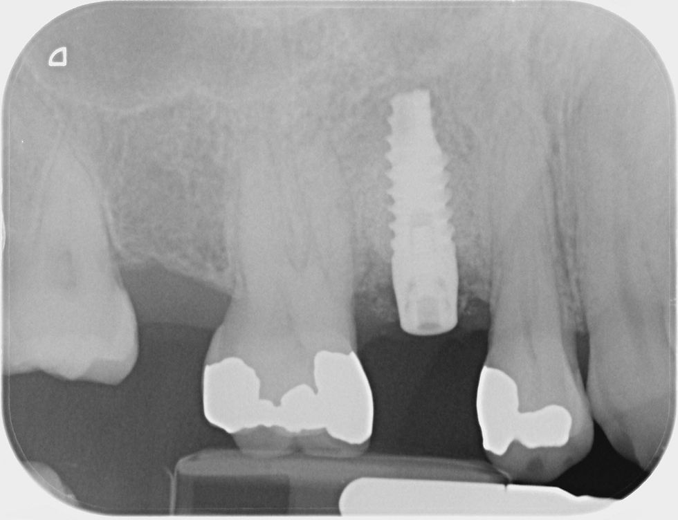 Foto per gentile concessione: Dott. Davide Guglielmi, Dott. Roberto Castellano.