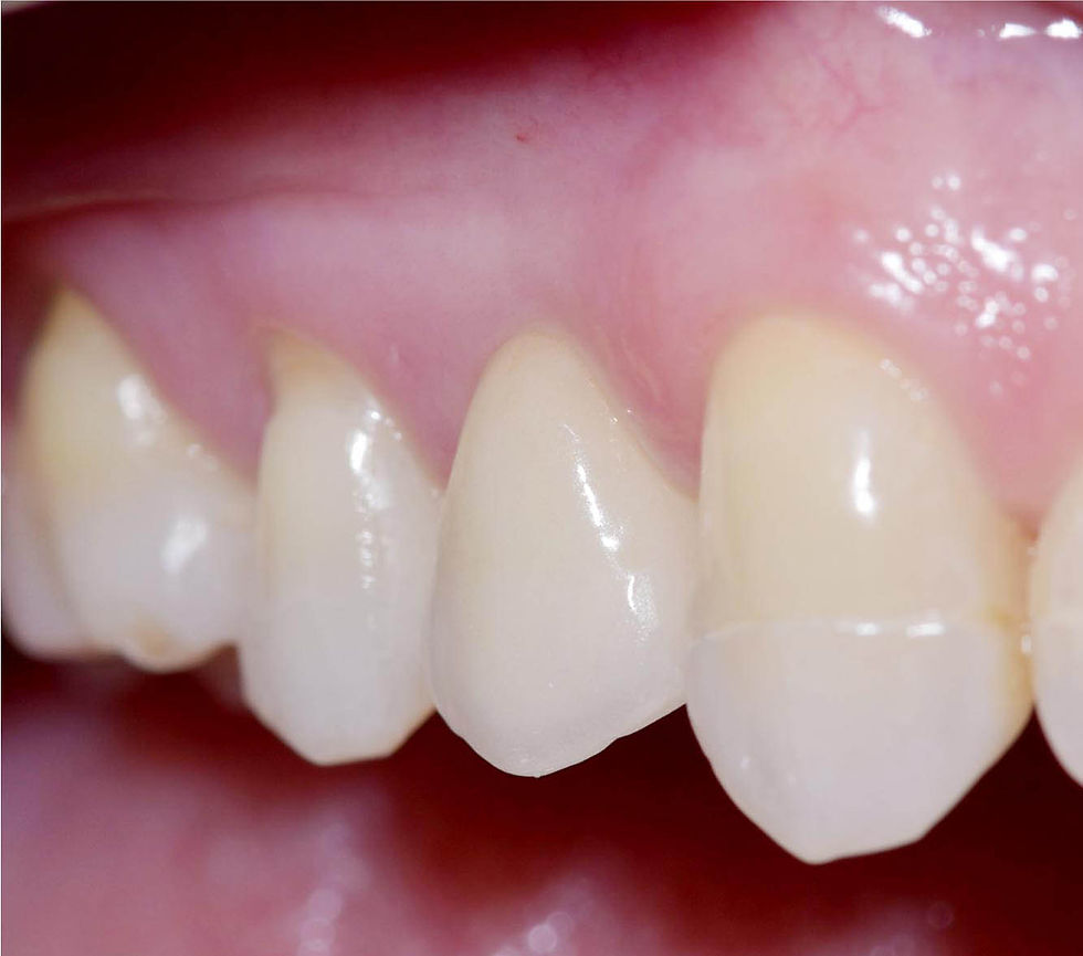 Image courtesy of: Dr. Costantino Vignato, Dr. Giuseppe Vignato