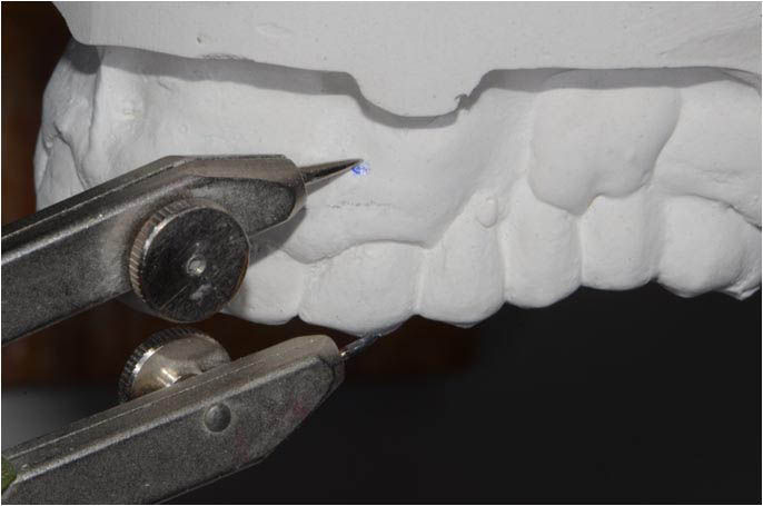 Image courtesy of: Dr. Leonello Biscaro