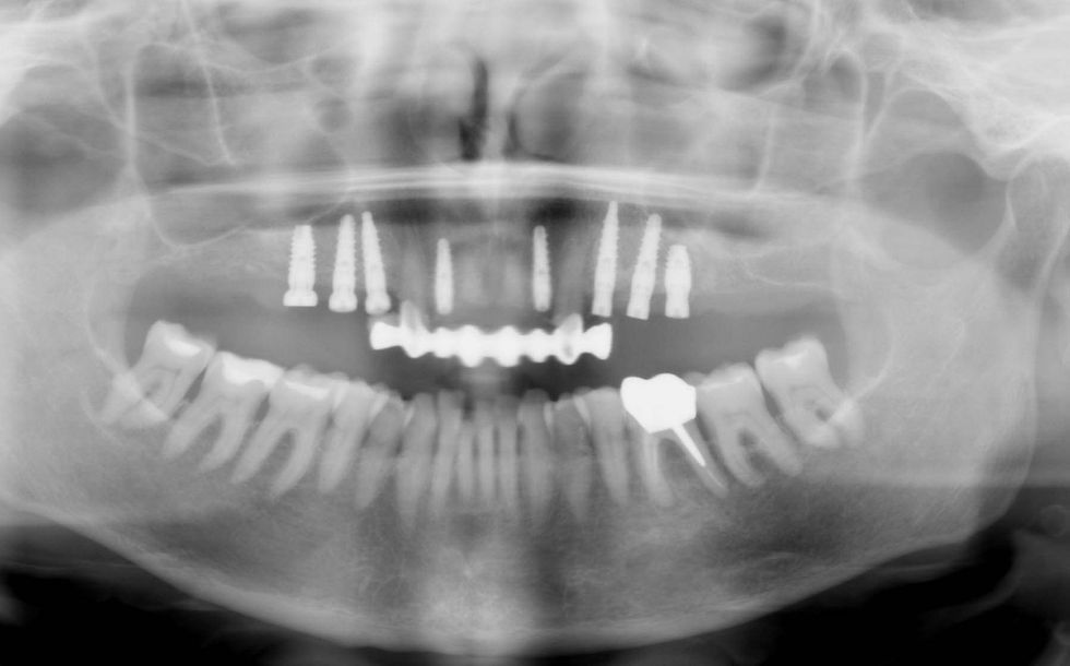 Image courtesy of: Prof. Antonio Barone, Dr. Fortunato Alfonsi