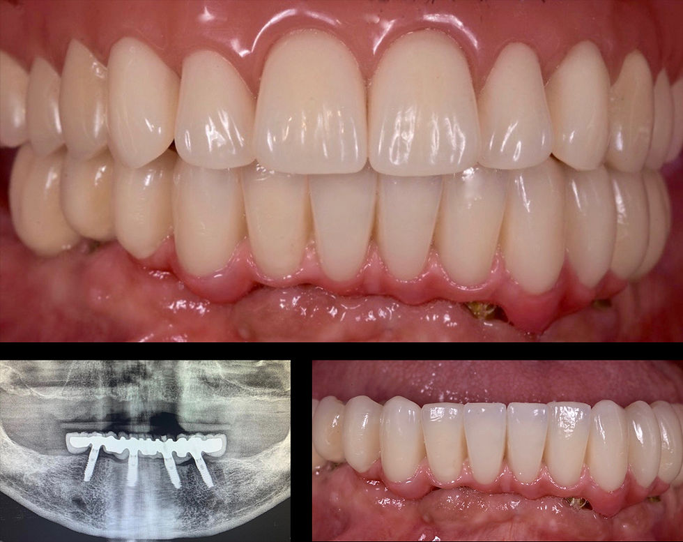 Image courtesy of: Gabriele Gori