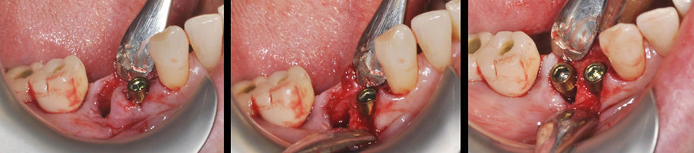 Image courtesy of: Prof. Marco Gargari, Dr. Federico Guzzo