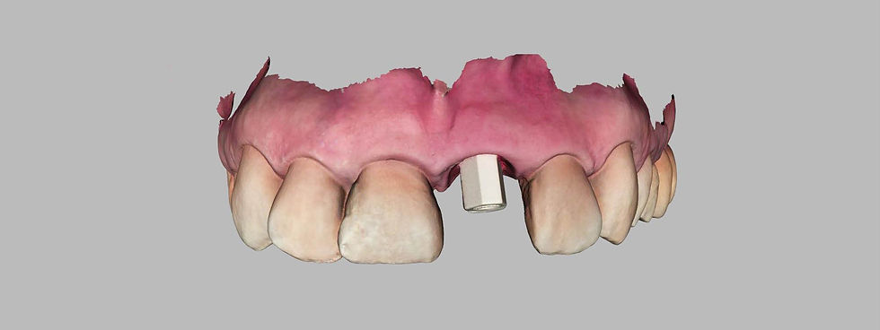 Image courtesy of: Dr. Paolo Nardinocchi