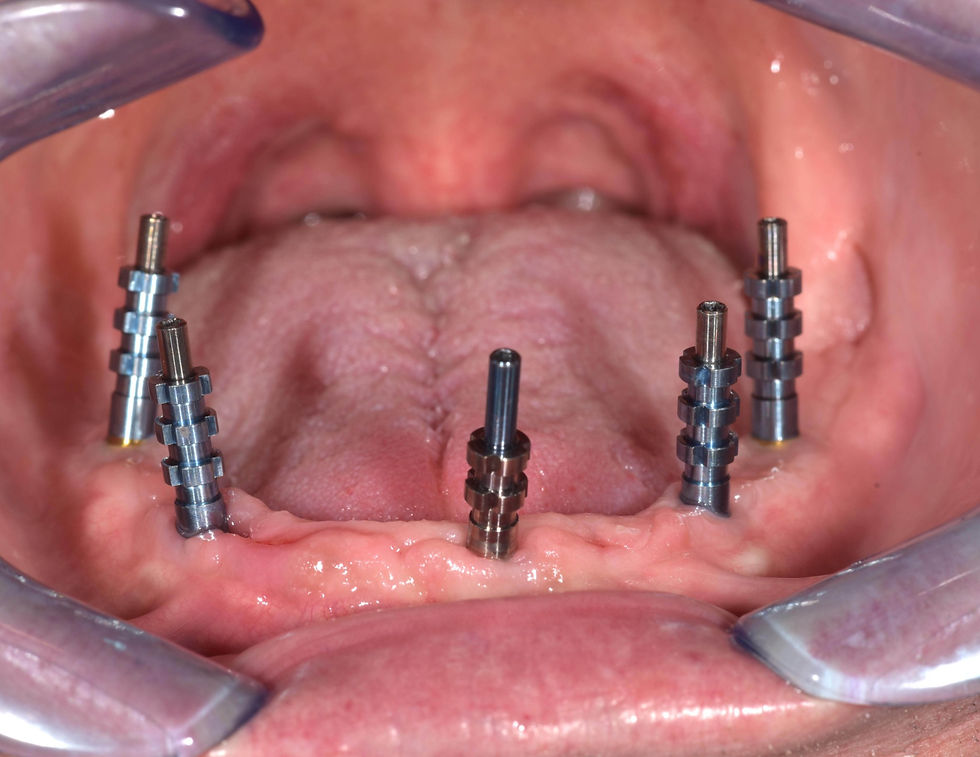 Image courtesy of: Dr. Costantino Vignato, Dr. Giuseppe Vignato