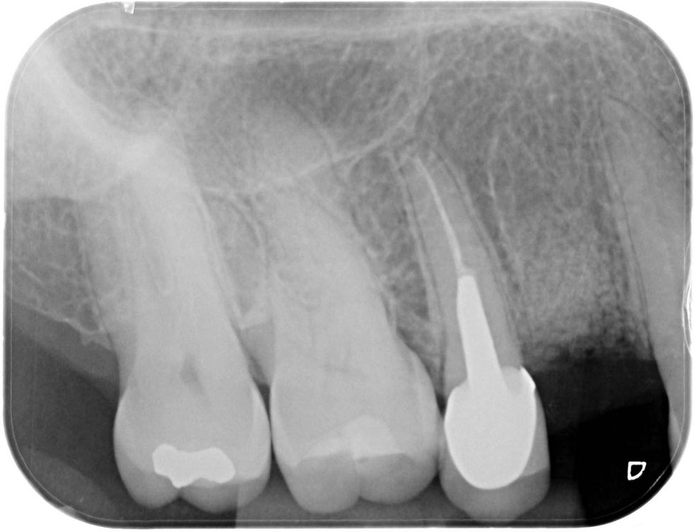 Image courtesy of: Dr. Costantino Vignato, Dr. Giuseppe Vignato.