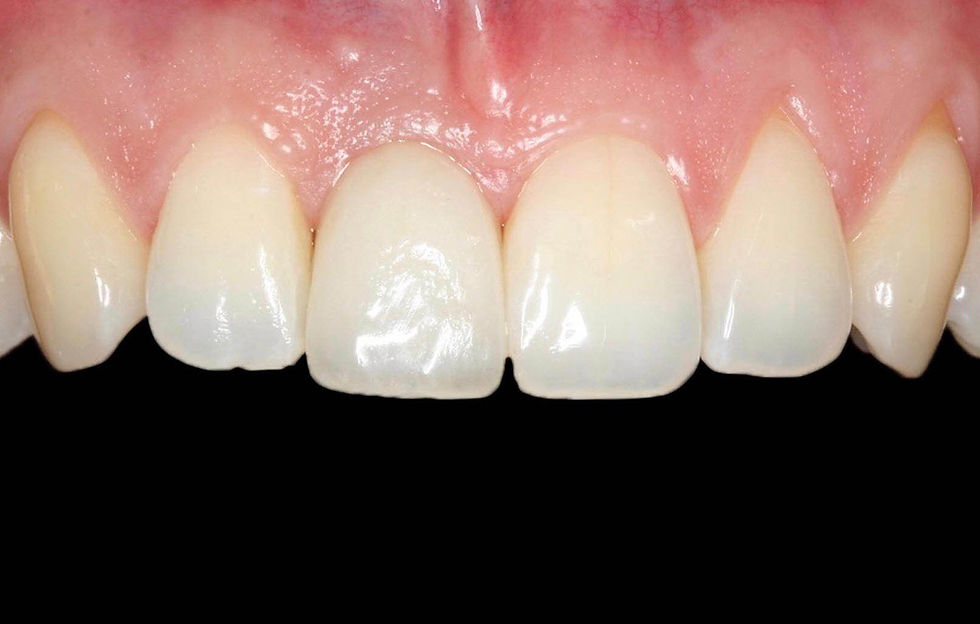 Image courtesy of: Prof. Berta GarcÃa Mira