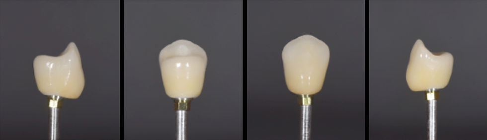 Image courtesy of: Dr. Costantino Vignato, Dr. Giuseppe Vignato