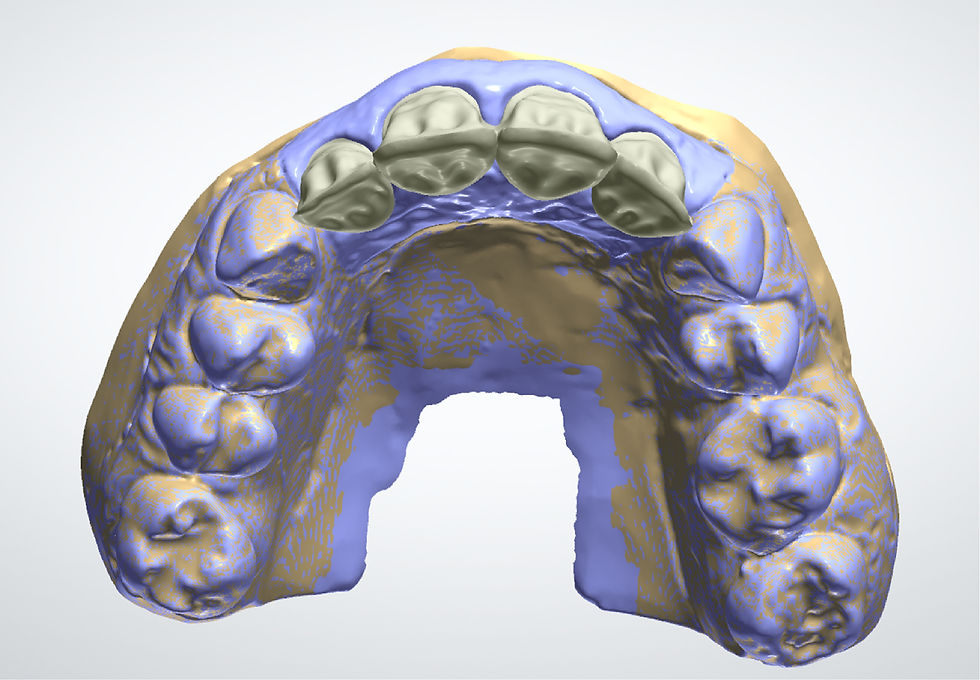 Image courtesy of: Dr. Xavier Vela Nebot, Dr. Xavier RodrÃguez Ciurana