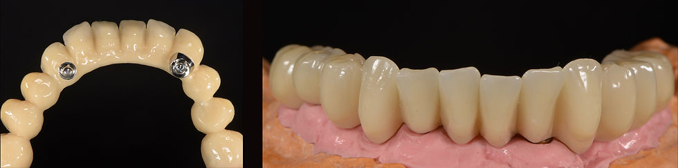 Image courtesy of: Gabriele Gori