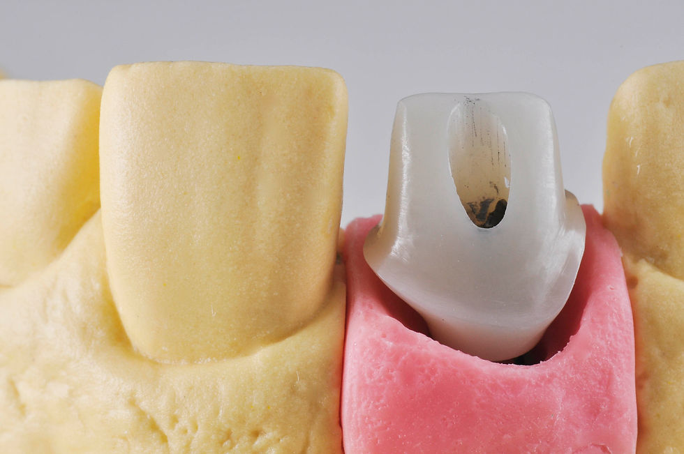 Image courtesy of: dr. Luigi Canullo