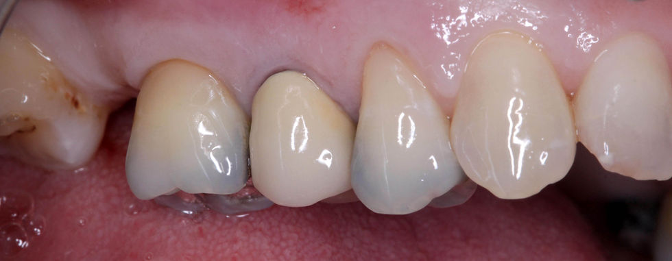 Foto per gentile concessione: Dott. Davide Guglielmi, Dott. Roberto Castellano.