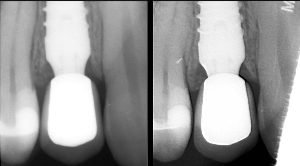 Image courtesy of: Dr. Costantino Vignato, Dr. Giuseppe Vignato