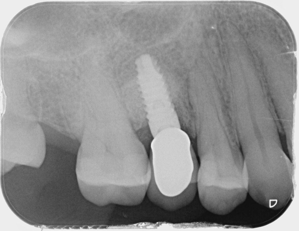 Foto per gentile concessione: Dott. Davide Guglielmi, Dott. Roberto Castellano.