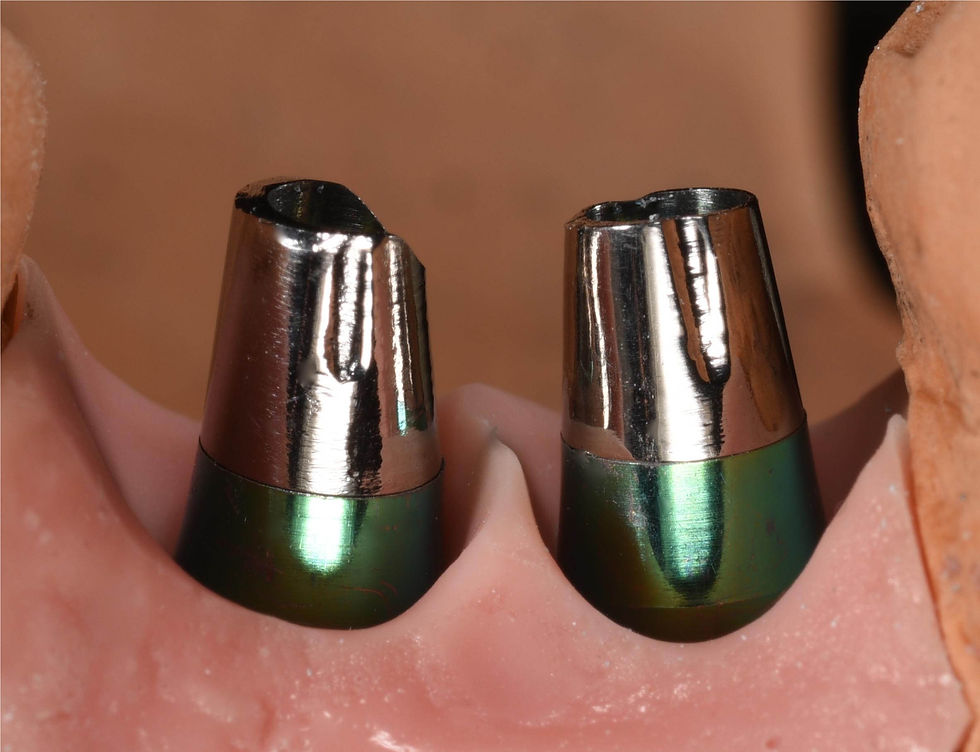 Foto per gentile concessione: Dott. Gioacchino Cannizzaro.