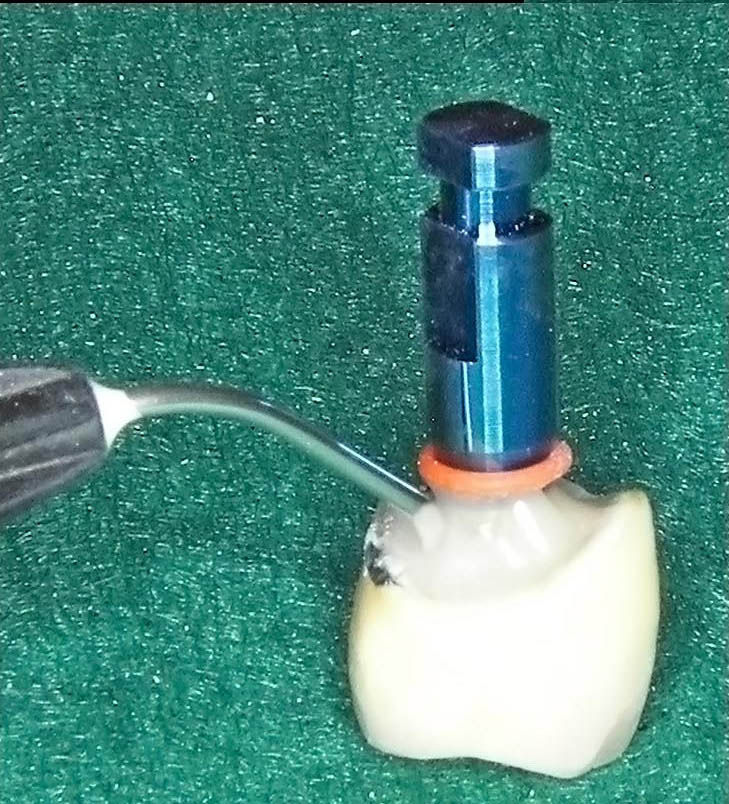 Image courtesy of: Dr. Guillermo Cabanes Gumbau