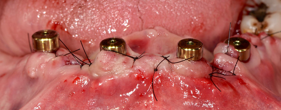 Image courtesy of: Gabriele Gori