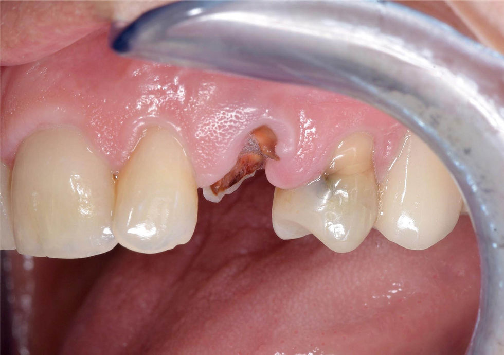 Image courtesy of: Dr. Costantino Vignato, Dr. Giuseppe Vignato