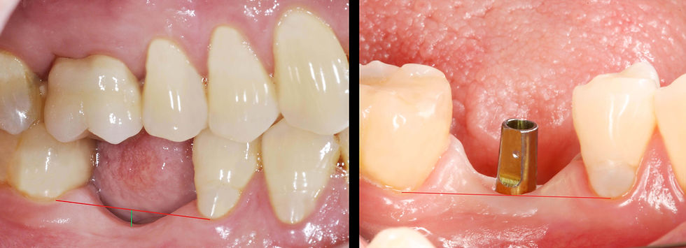 Image courtesy of: Dr. Paolo Nardinocchi