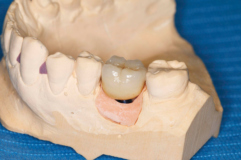 Image courtesy of: Dr. Paolo Nardinocchi