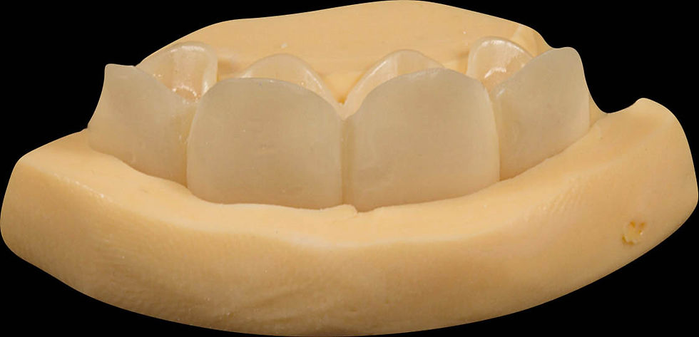 Image courtesy of: Dr. Xavier Vela Nebot, Dr. Xavier RodrÃguez Ciurana