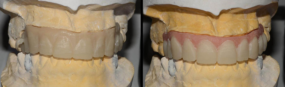 Image courtesy of: Dr. Leonello Biscaro