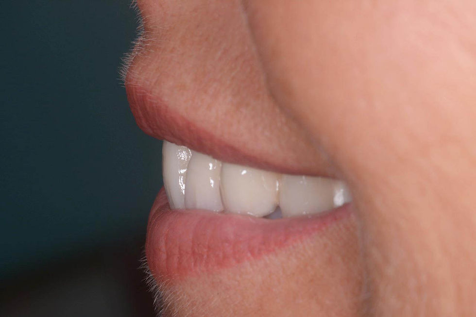 Image courtesy of: Dr. Giuseppe Pellitteri