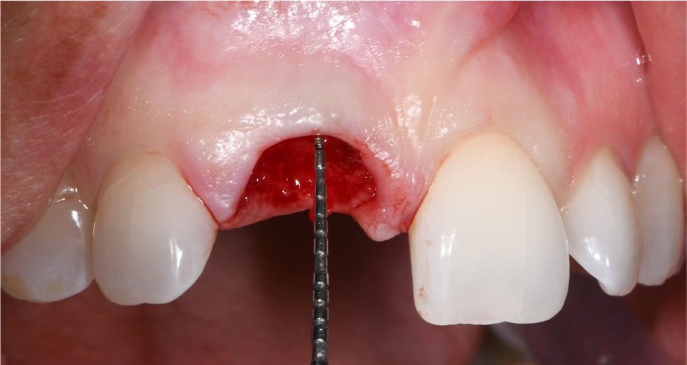 Image courtesy: Dr. Roberto Luongo