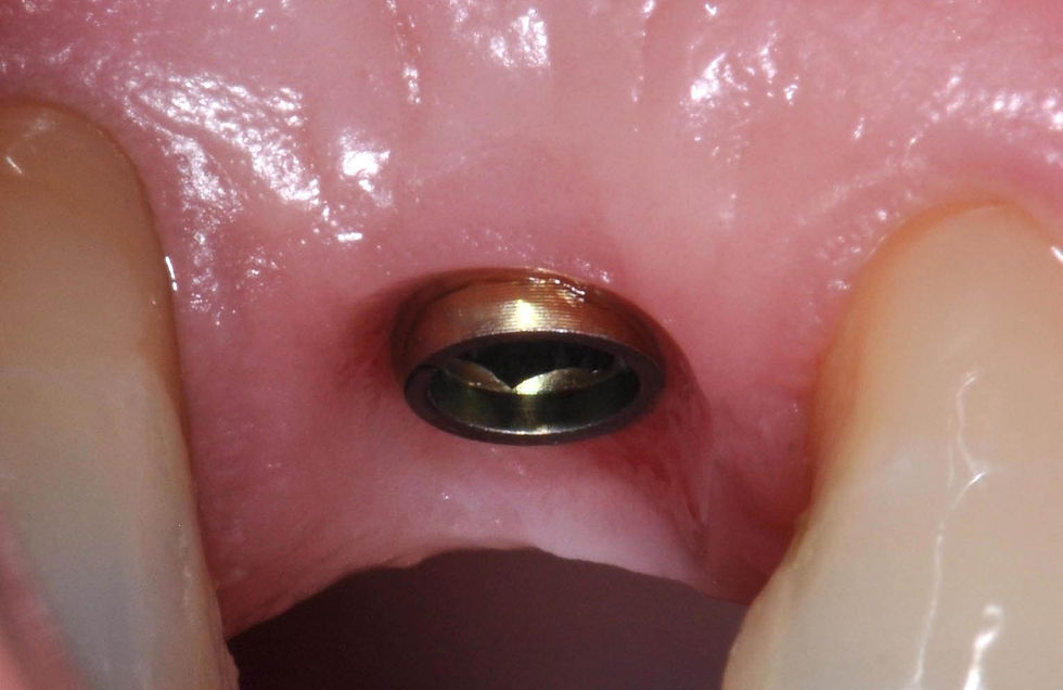 Foto per gentile concessione: Dott. Davide Guglielmi, Dott. Roberto Castellano.