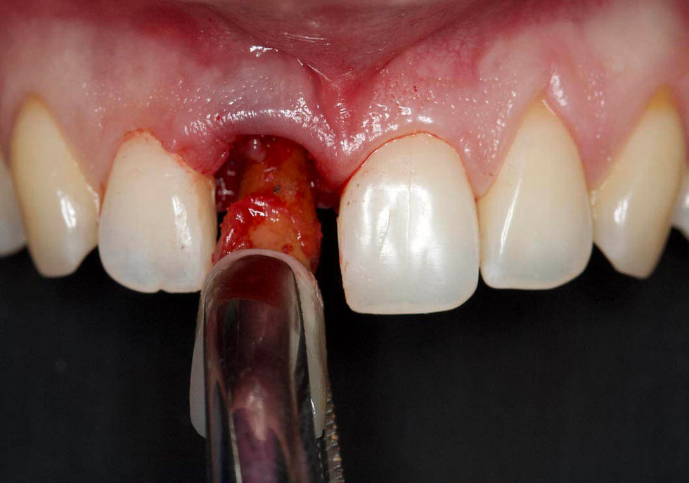 Image courtesy of: Prof. Berta GarcÃa Mira