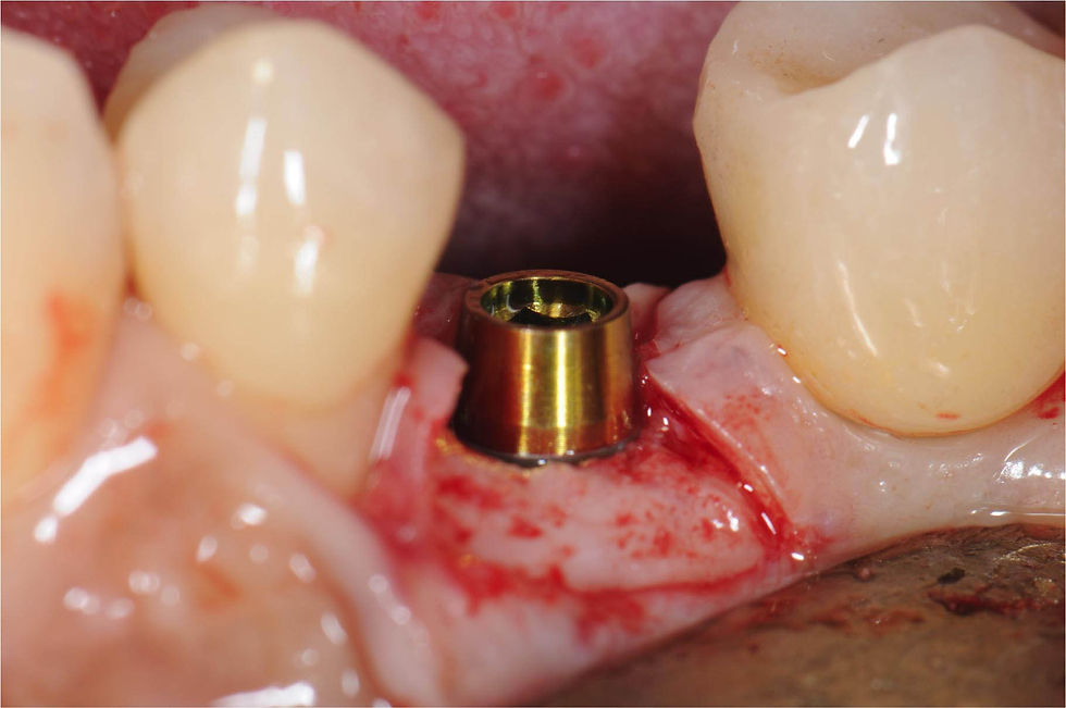 Image courtesy of: Dr. Costantino Vignato, Dr. Giuseppe Vignato.