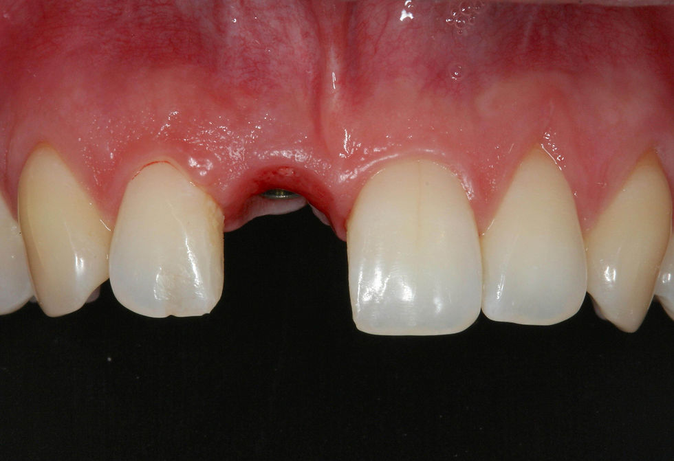 Image courtesy of: Prof. Berta GarcÃa Mira