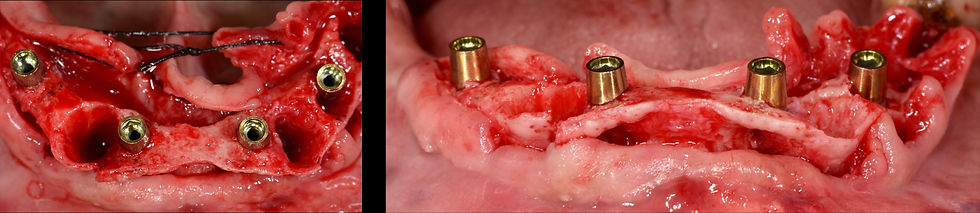 Image courtesy of: Gabriele Gori