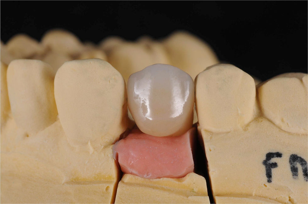 Image courtesy of: Dr. Costantino Vignato, Dr. Giuseppe Vignato.