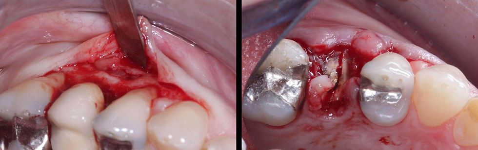 Foto per gentile concessione: Dott. Davide Guglielmi, Dott. Roberto Castellano.