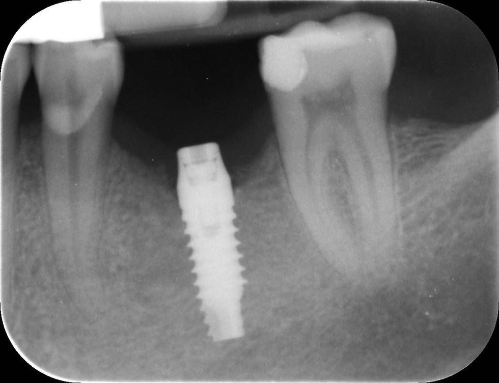 Image courtesy of: Dr. Paolo Nardinocchi