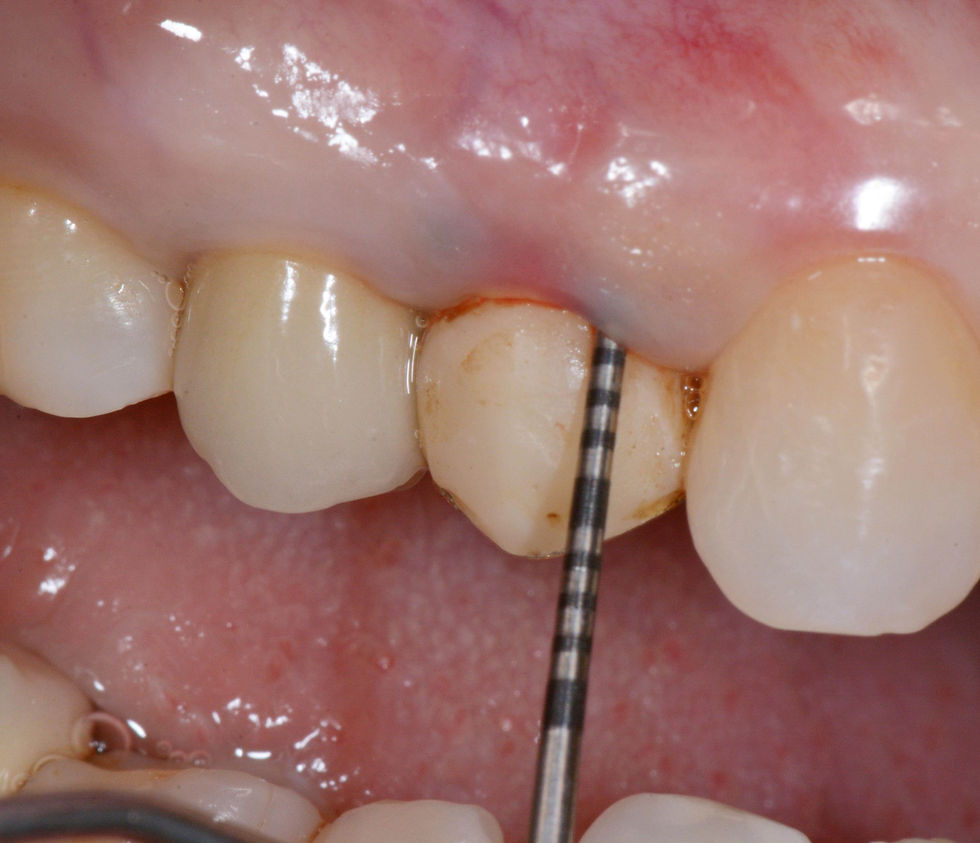 Image courtesy of: Dr. Costantino Vignato, Dr. Giuseppe Vignato.