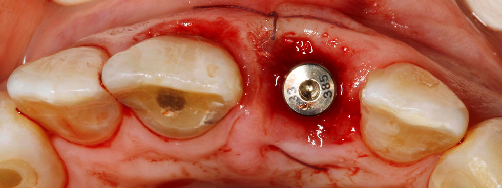 Image courtesy of: Dr. Paolo Nardinocchi