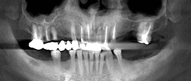 Image courtesy of: Dr. Leonello Biscaro