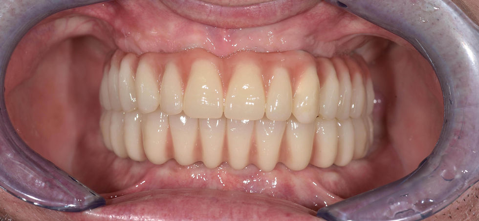 Image courtesy of: Dr. Costantino Vignato, Dr. Giuseppe Vignato