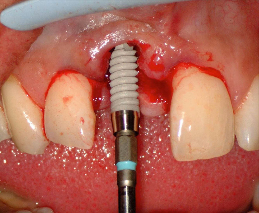 Image courtesy of: Dr. Fabio Gorni.